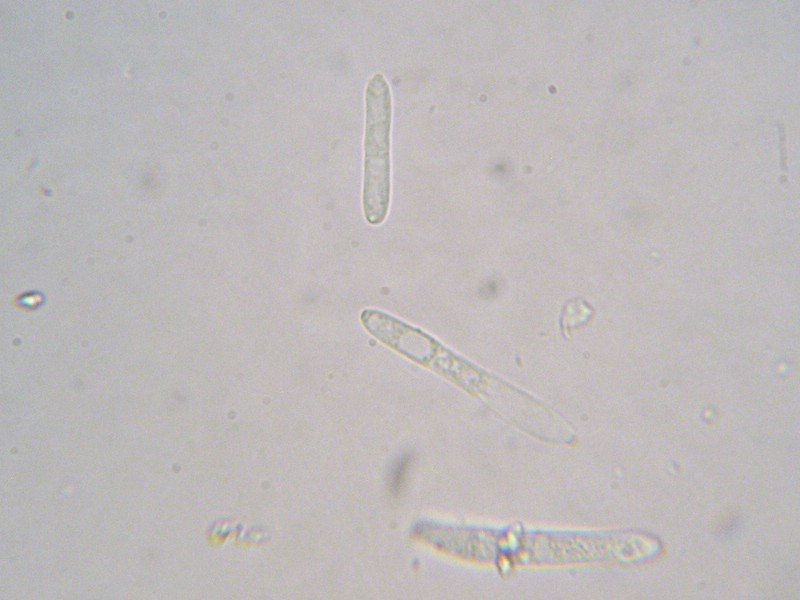 1000er Berchtes (4).jpg