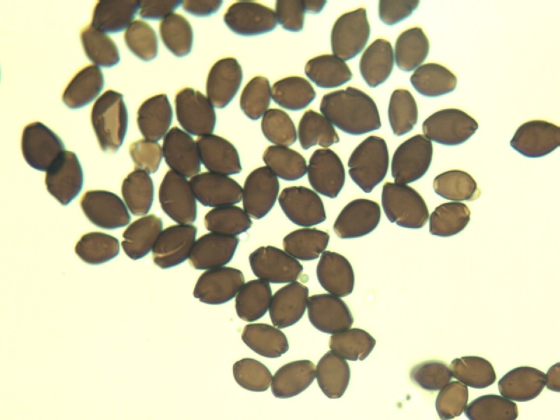 Coprinellus sp_Sporen.jpg