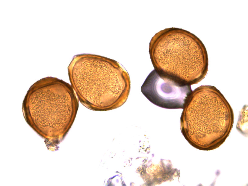 Puccinia_semadenii_05.jpg