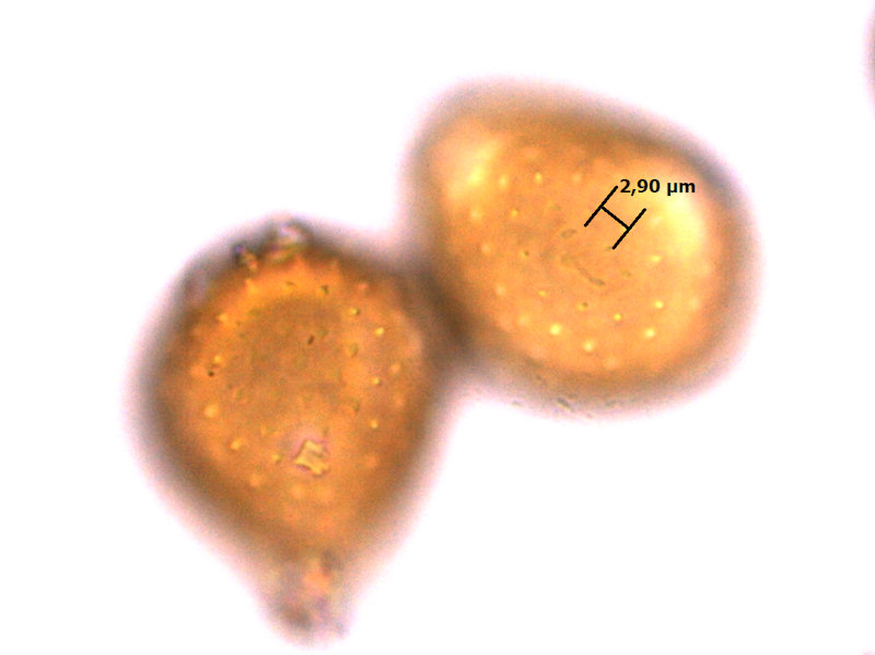 Puccinia_semadenii_07.jpg
