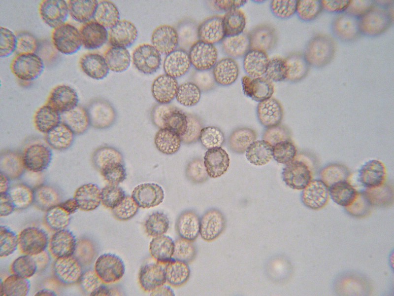 1000er Epinel (2).jpg