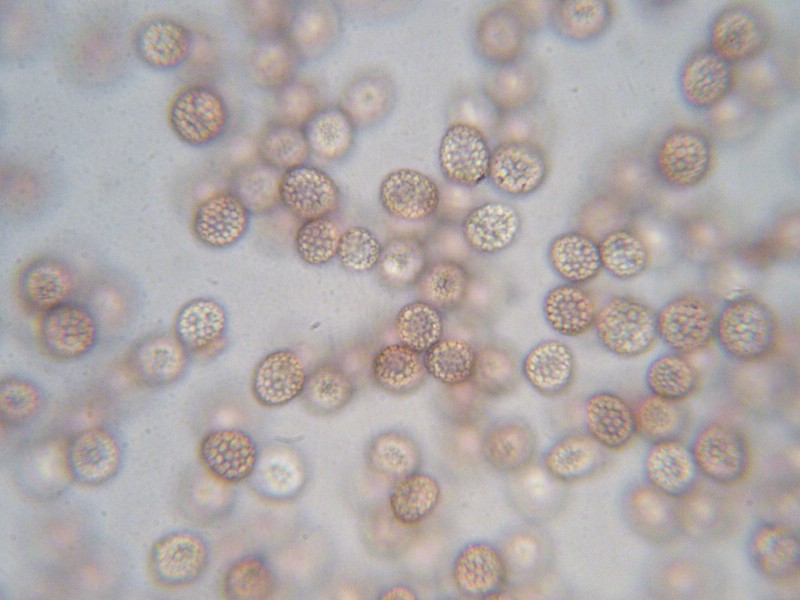 1000er Epinel (7).jpg