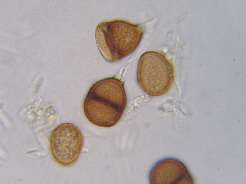 1000er Epinel (7).jpg