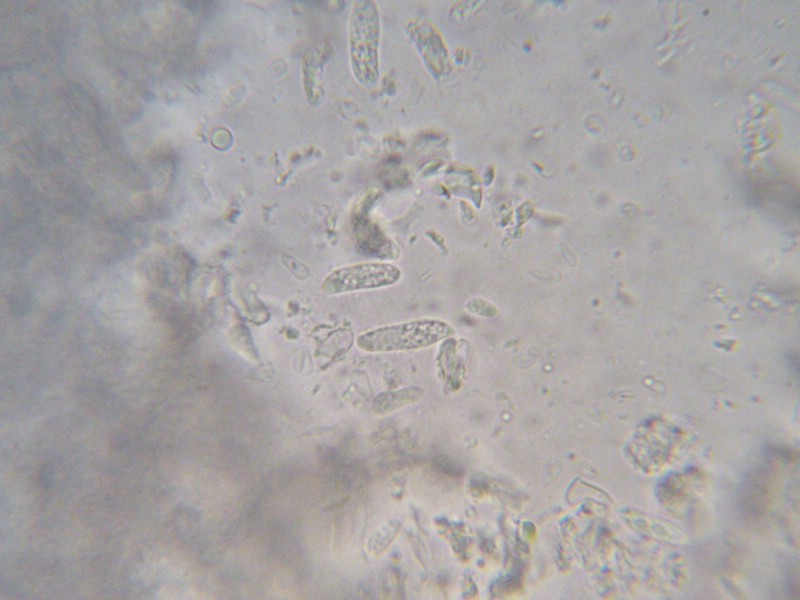 Exobasidium vaccinii-uliginosi_Vaccinium uliginosum_JKruse (6).jpg