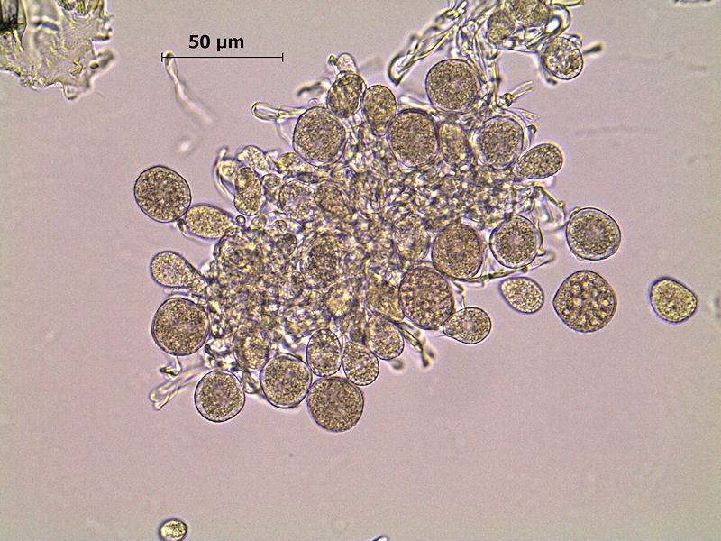 Puccinia_menthae_5.jpg