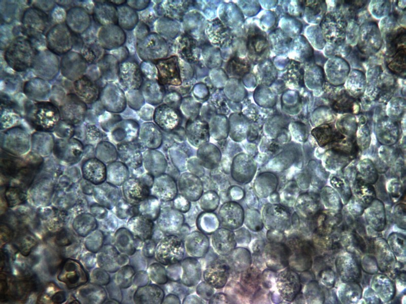 Zellen der Huthaut.jpg