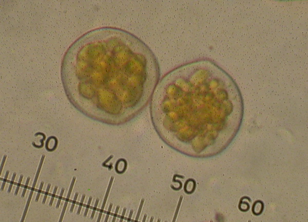 Puccinia cf - - Clematis vitalba 06-_.jpg