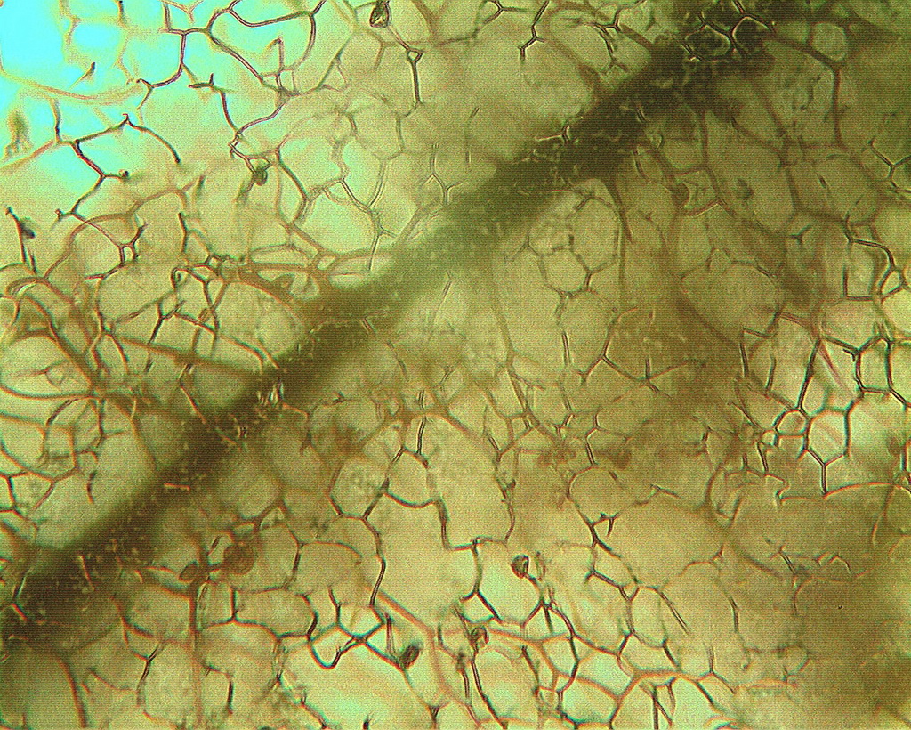 Capillitiumnetz um Columella, Detail