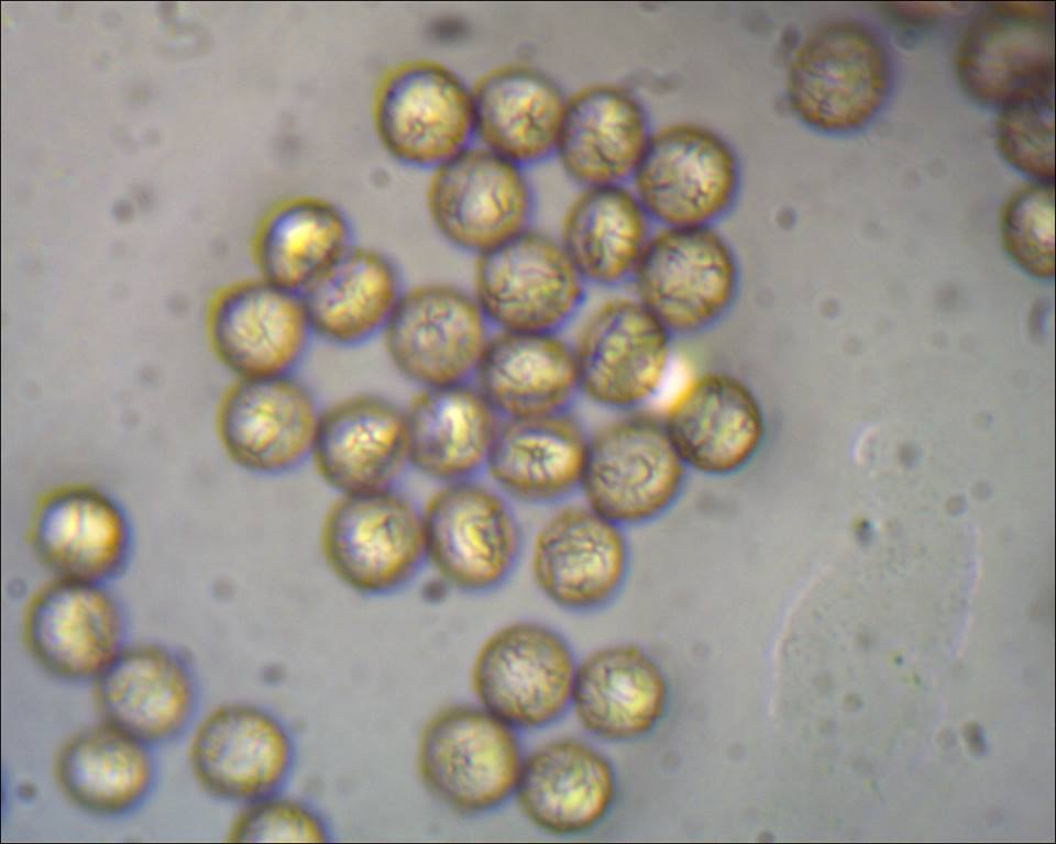 Idealbild der Sporen. [Dieses Bild ist NICHT von mir]