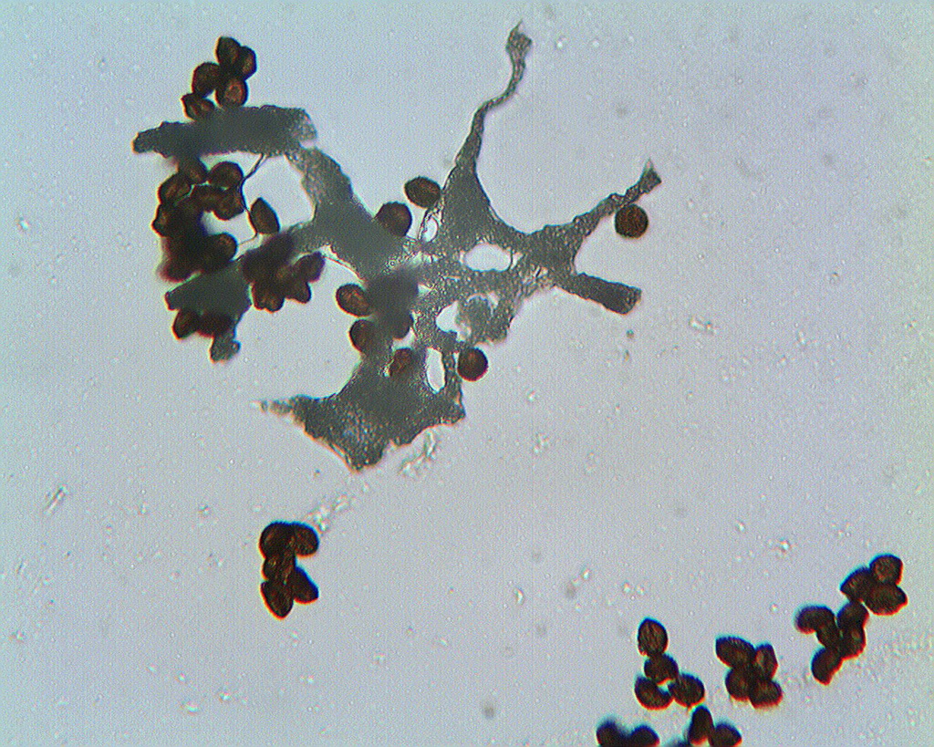 Capillitium und Sporen