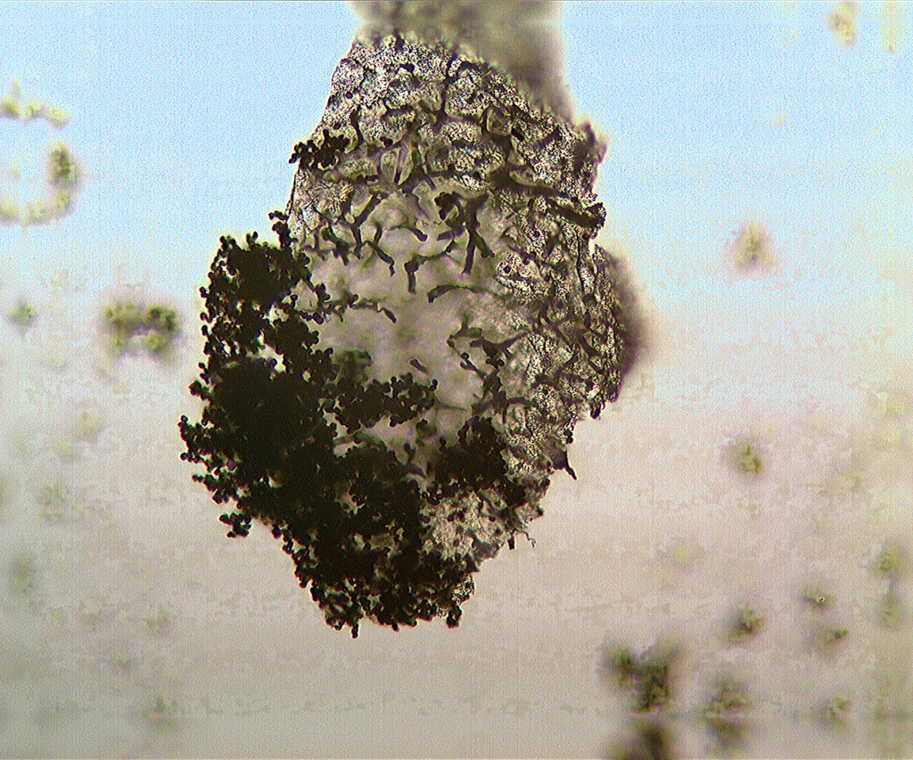 Peridie und Capillitium