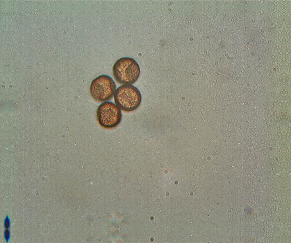 Sporen