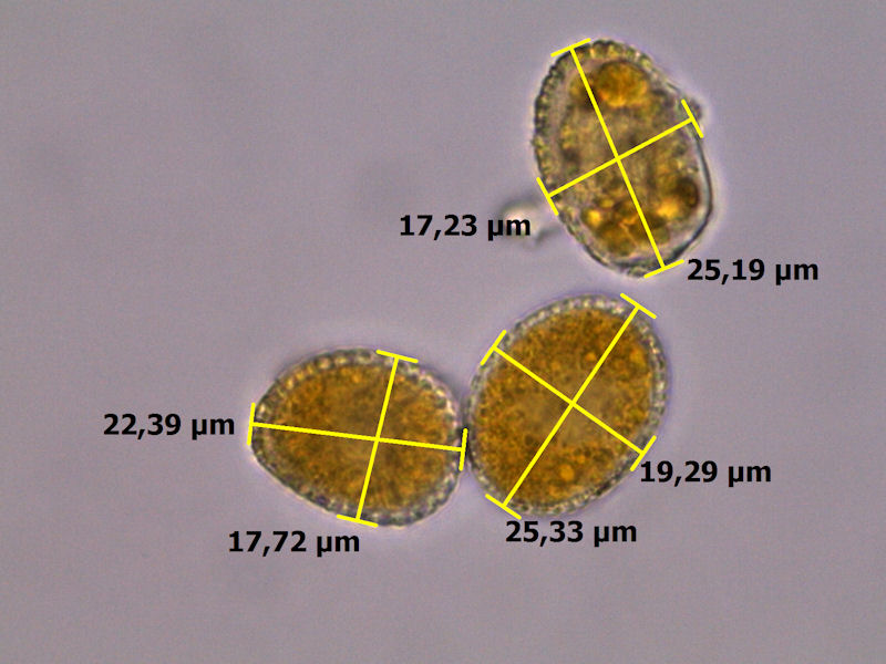 Coleosporium_tussilaginis_06.JPG