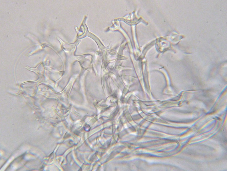 Bremia lactucae_M (1).jpg