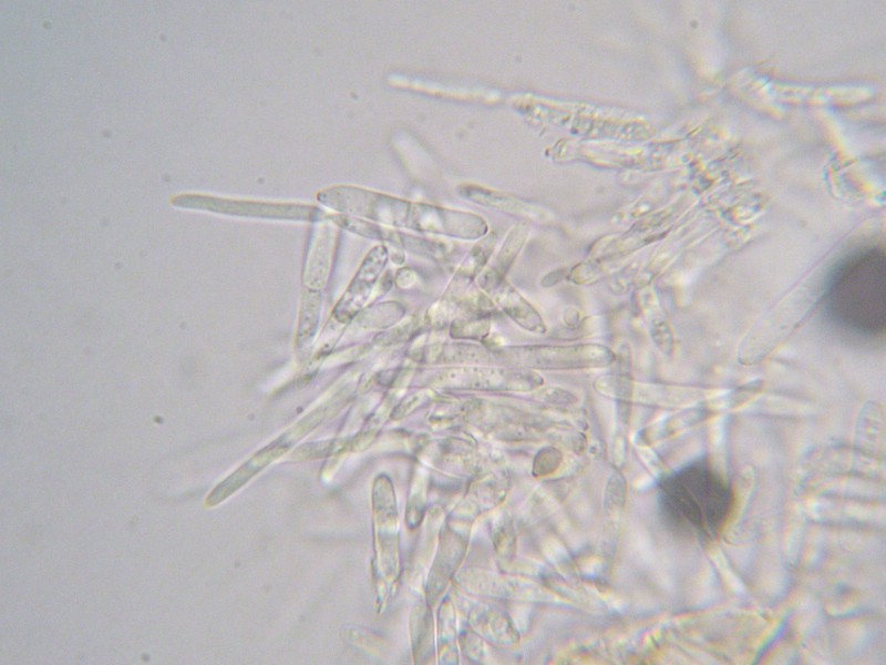 Ramularia inaequale_M (2).jpg