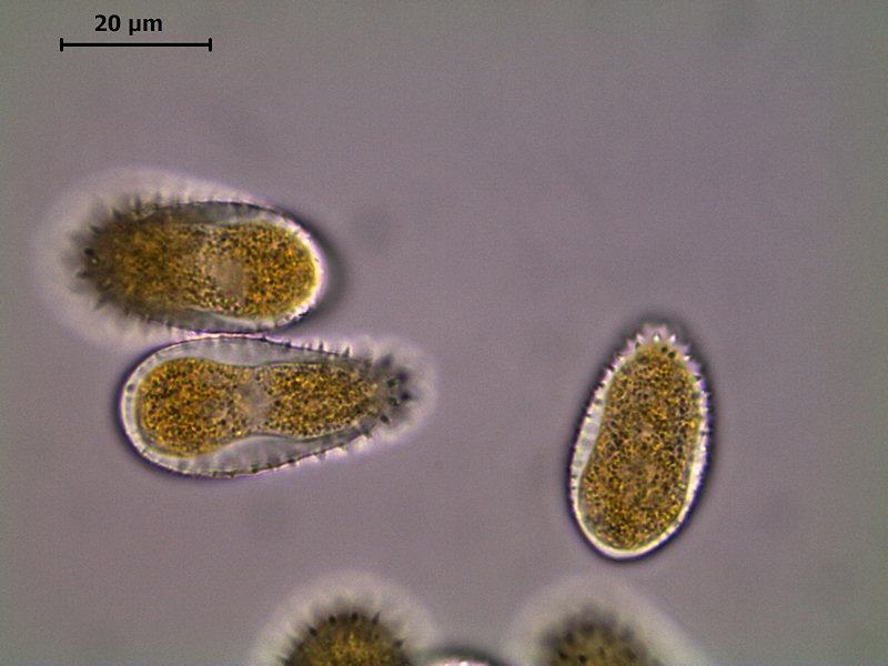 Melampsora_ larici-populina_6.jpg