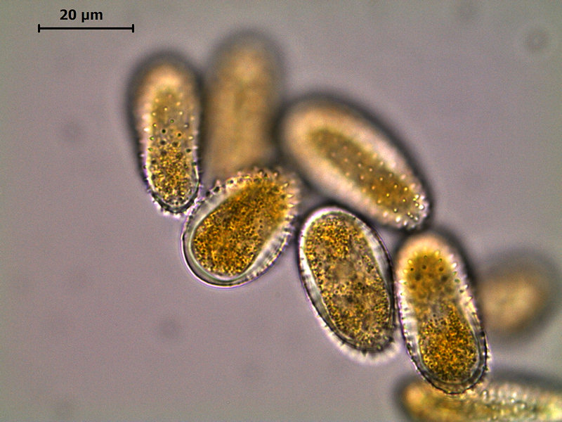 Melampsora_ larici-populina_7.jpg