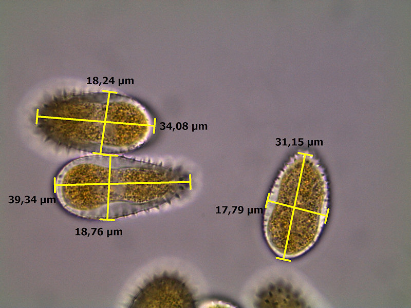 Melampsora_ larici-populina_8.jpg