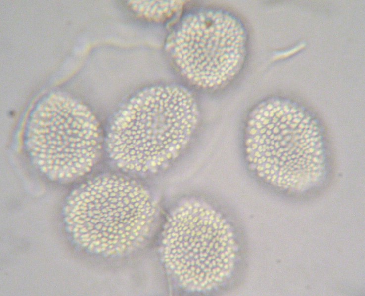 Coleosporium cacaliae_A glabra (2).jpg