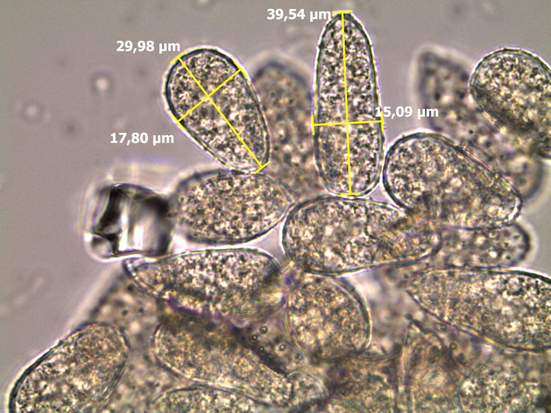 Melampsoridium_betulinum_6.jpg