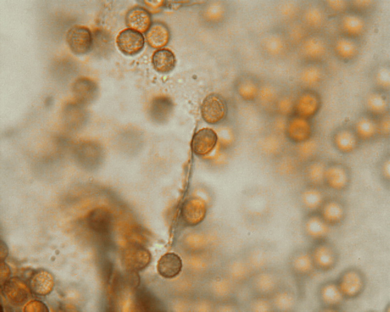 Tubifera_ferruginosa-Capill-mit Sporen klein.jpg