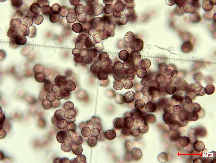 Microbotryum scorzonerae Teliosporen 1.jpg