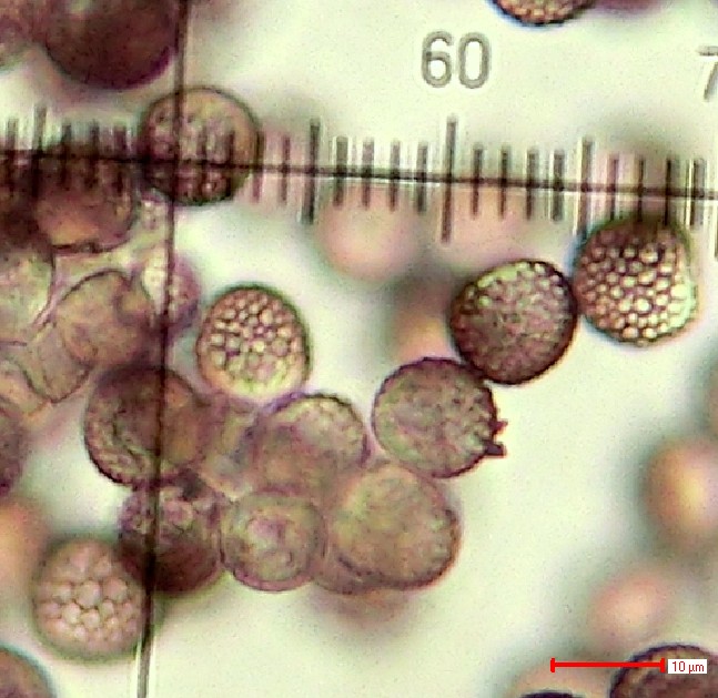 Microbotryum scorzonerae Teliosporen 2.jpg