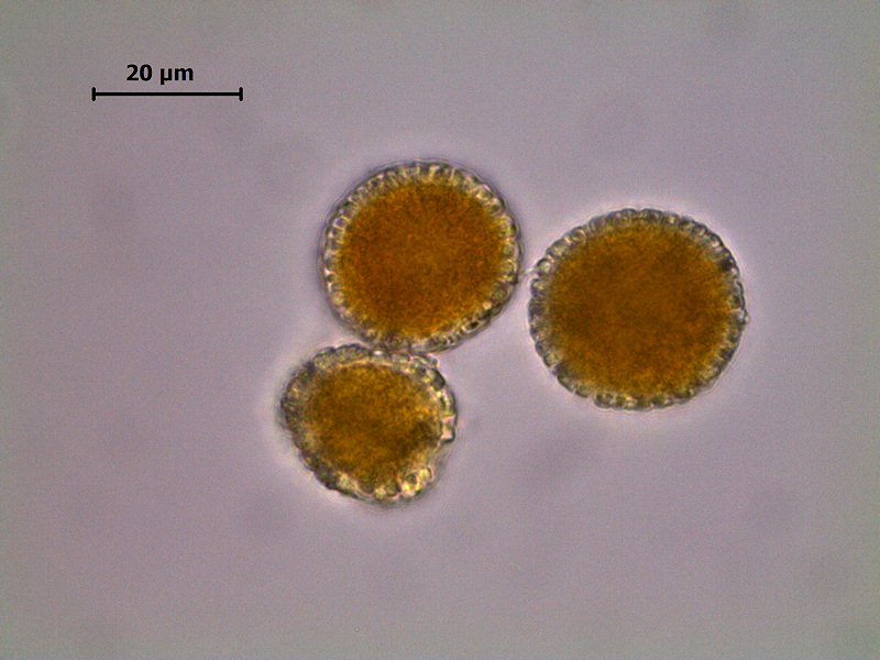 Coleosporium_cacaliae_7.jpg