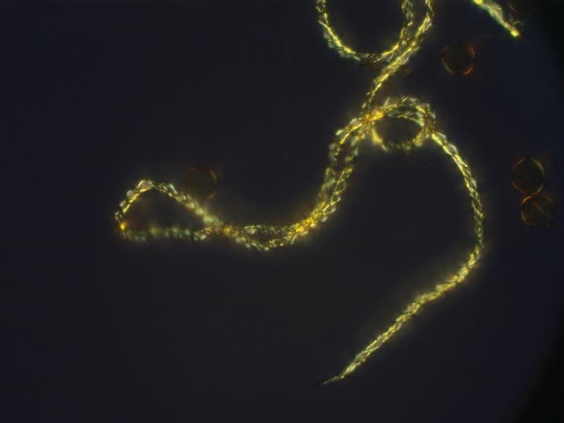 Trichia varia Capillitium.jpg