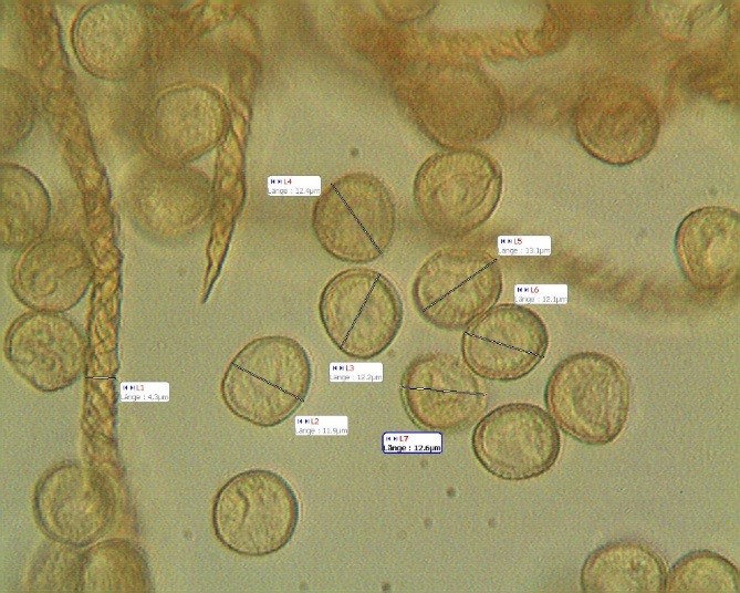 Trichia contorta Sporen klein.jpg