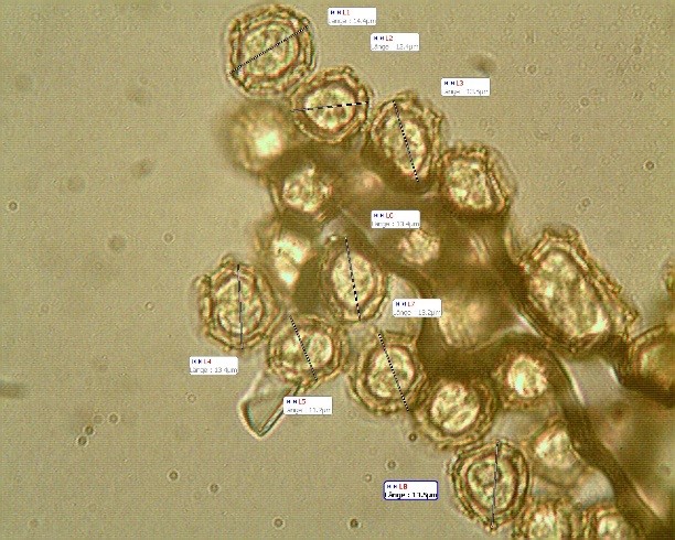 Trichia affinis Sporen klein.jpg