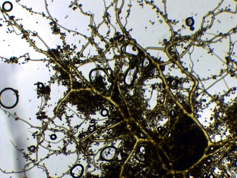 Bov. plumbea_Capillitium-1.jpg