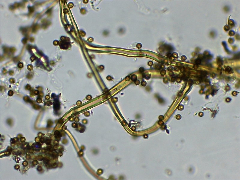 Bov. plumbea_Capillitium-2.jpg