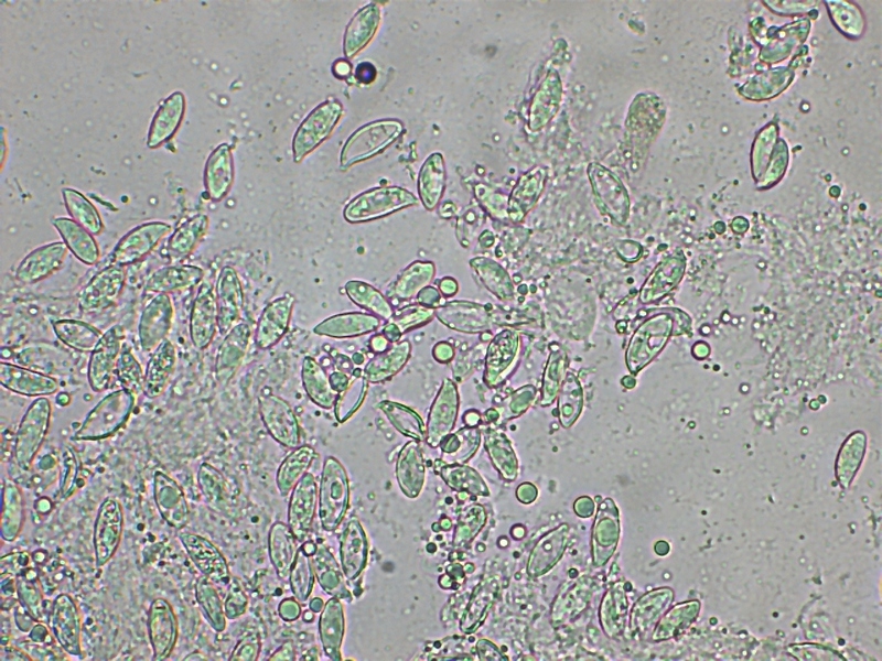 Lepiota sp._Sporen.jpg