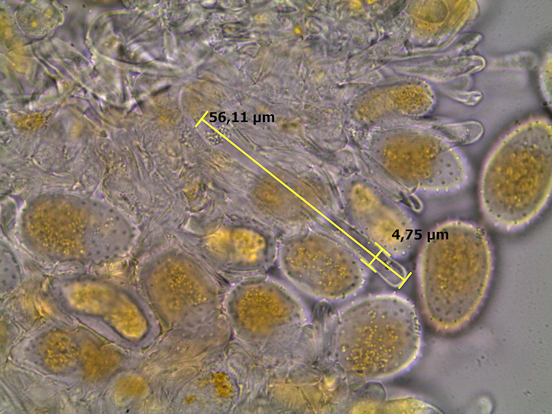 Puccinia_graminis_5.jpg