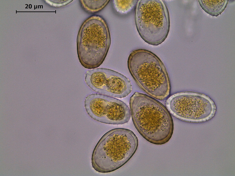 Puccinia_graminis_6.jpg