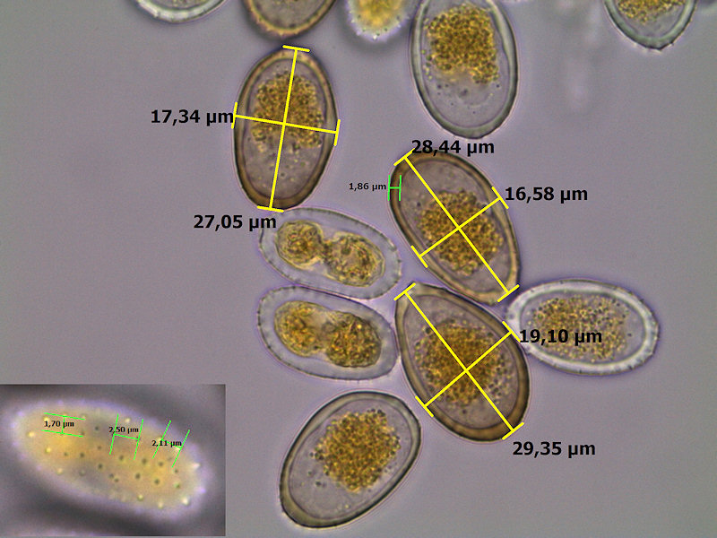 Puccinia_graminis_7.jpg