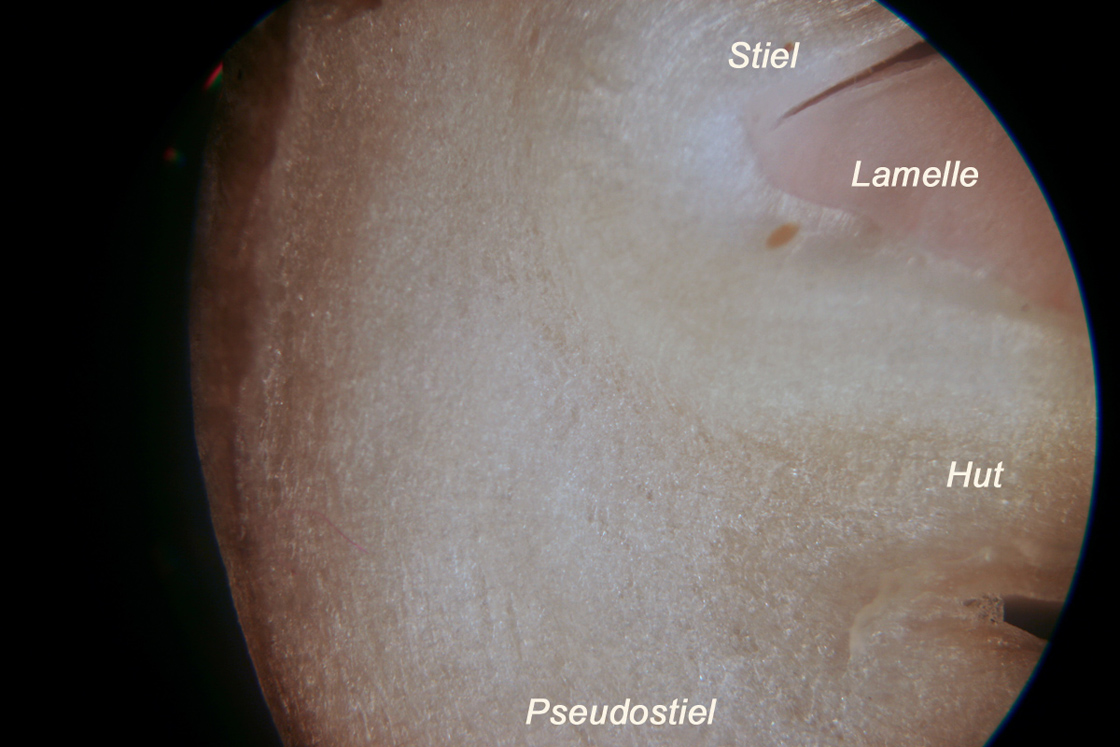 Mycena_strobilicola-Schnitt_26_bwT_20x.jpg