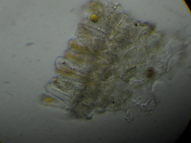 TaphrinaJohansonii-H40-9.8mm-0006-8x.jpg