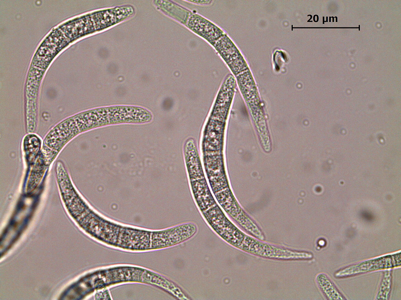 Mycosphaerella_ulmi_4.jpg