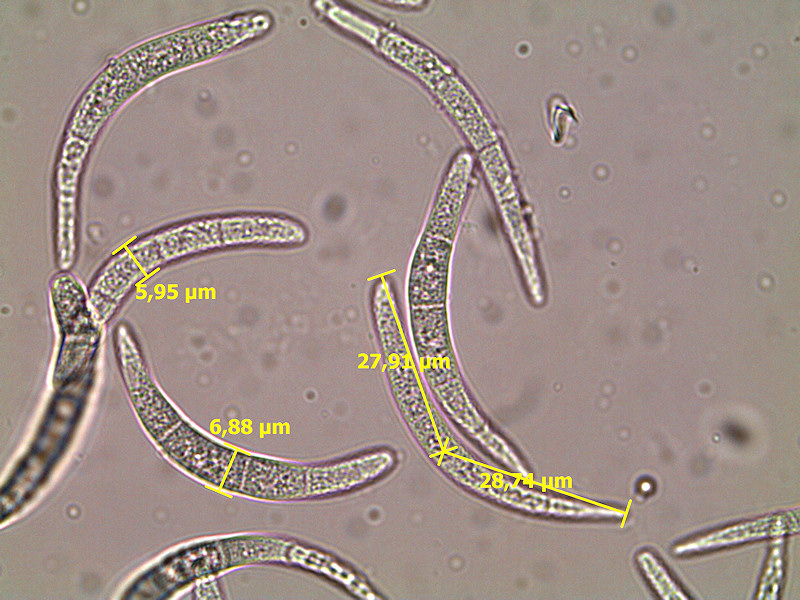 Mycosphaerella_ulmi_5.jpg
