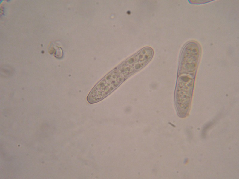 1000er Schwarzh (5).JPG