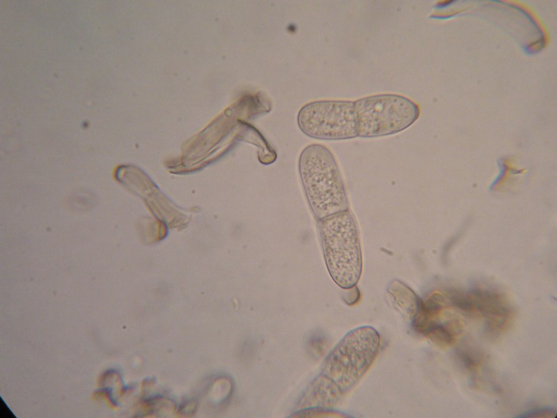 1000er Schwarzh (25).JPG