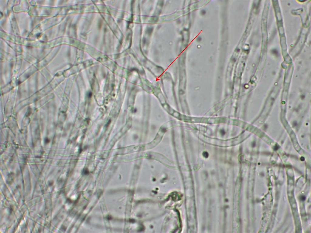 Hyphen mit Schnallen  bei  C. collinitus