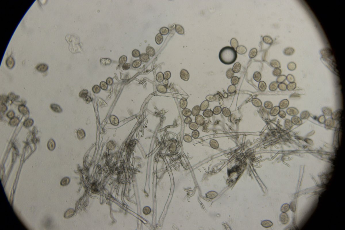 Halde Rungenberg-3679.jpg