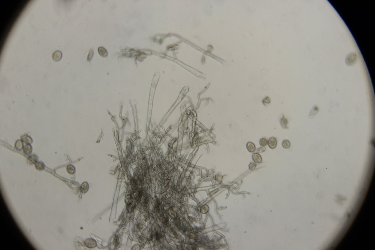 Halde Rungenberg-3681.jpg