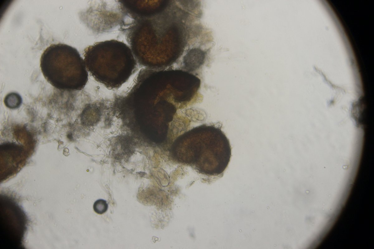 Halde Rungenberg-3697.jpg