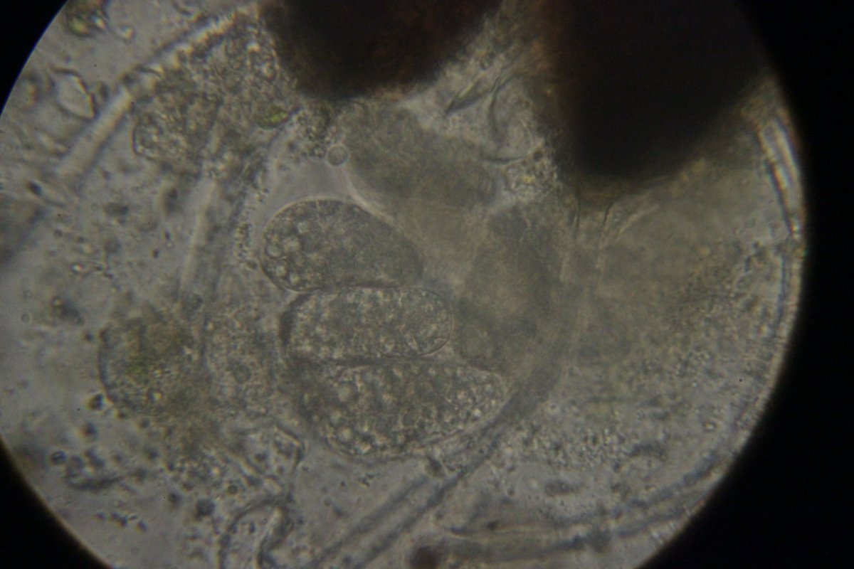 Halde Rungenberg-3710.jpg