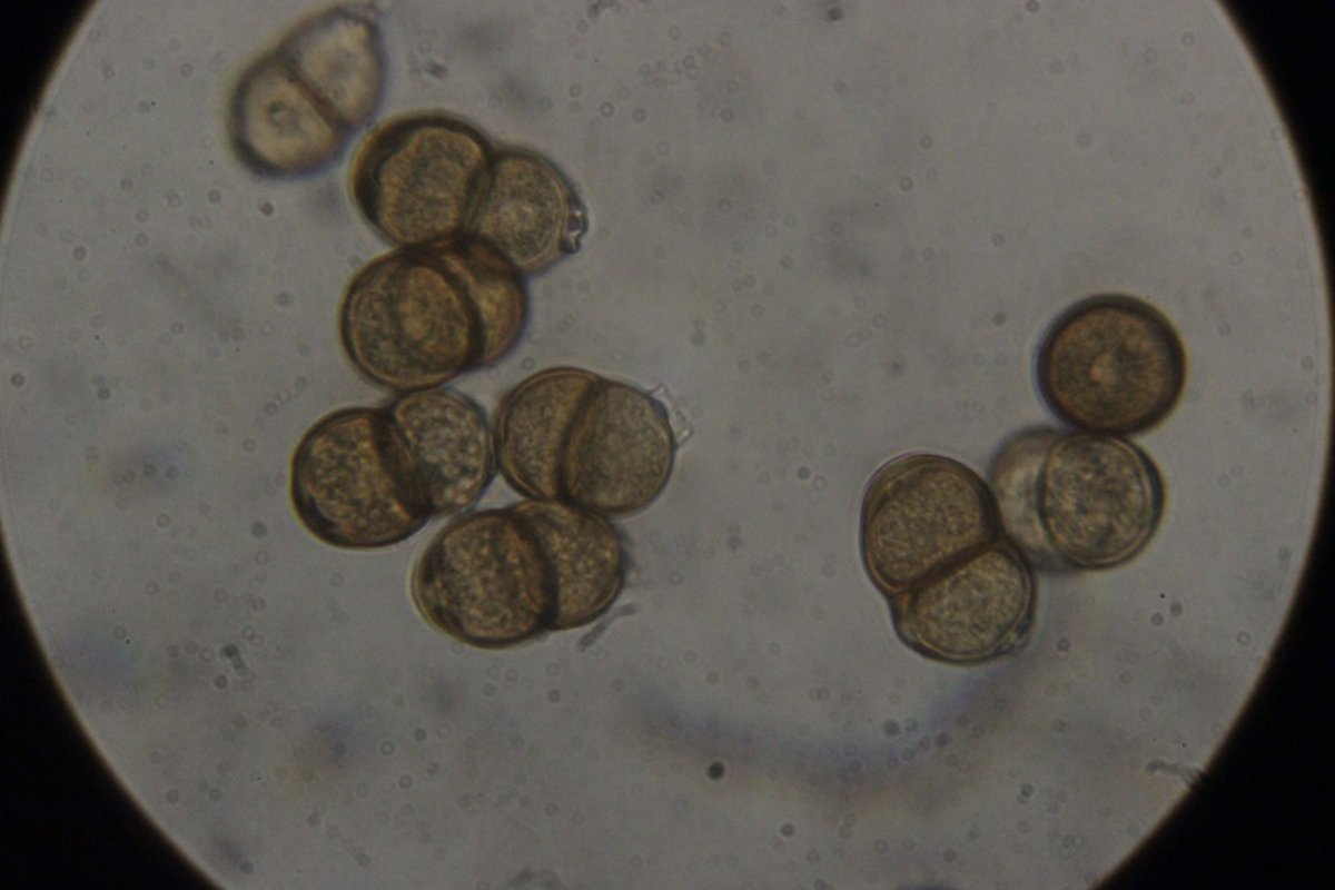 Halde Rungenberg-3734.jpg