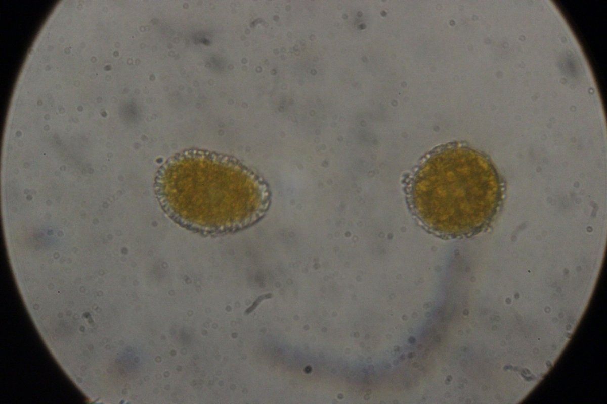 Halde Rungenberg-3744.jpg